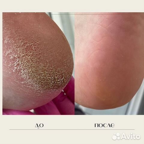 Маникюр, педикюр