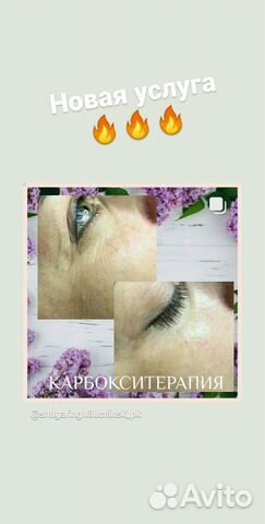 Депиляция (шугаринг, ваксинг), Скульптурный массаж