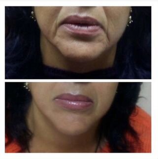 Массаж лица и тела, косметолог