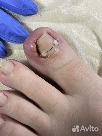 Выезд на дом, подолог