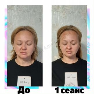 Скульптурный массаж лица